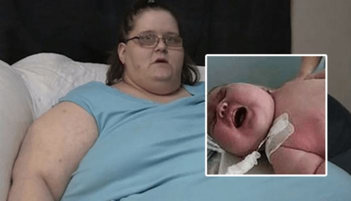 O femeie de 272 de kilograme a nascut cel mai mare copil din lume. Medicii au crezut ca sunt 2 sau 3 bebelusi